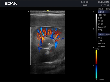 EDAN Acclarix AX3 VET
