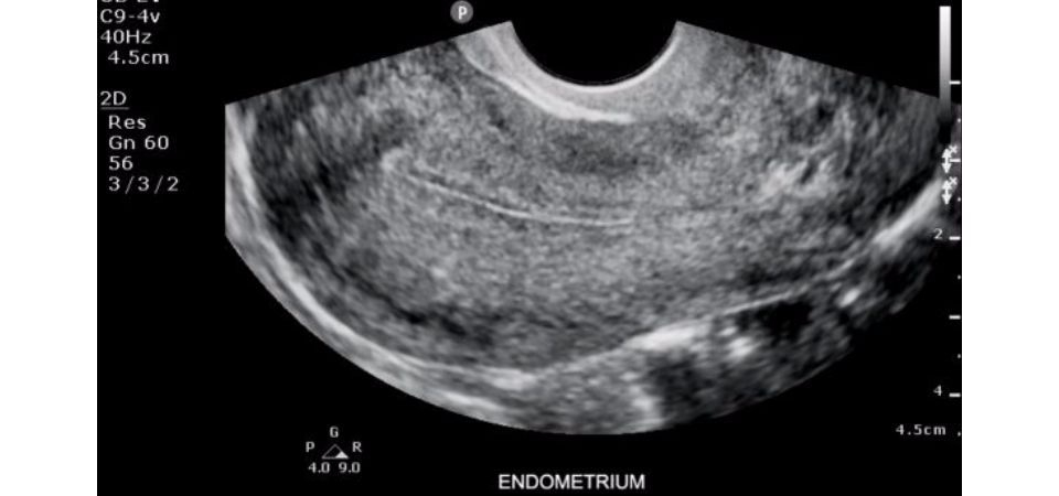 Philips ClearVue 550