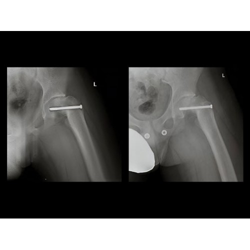 Рентген аппарат GE Discovery XR656