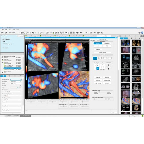 ViewPoint 6 для ультразвуковых исследований в области Женского здоровья